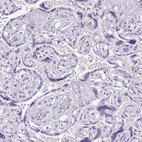 Immunohistochemical staining of human placenta shows low expression as expected.