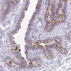Immunohistochemical staining of human fallopian tube shows high expression.