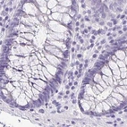 Immunohistochemical staining of human colon using Anti-ANKRD45 antibody HPA031656.