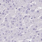 Immunohistochemical staining of human liver using Anti-ANKRD45 antibody HPA031656.