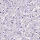 Immunohistochemical staining of human liver using Anti-ANKRD45 antibody HPA031656.