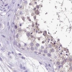 Immunohistochemical staining of human testis using Anti-ANKRD45 antibody HPA031656.