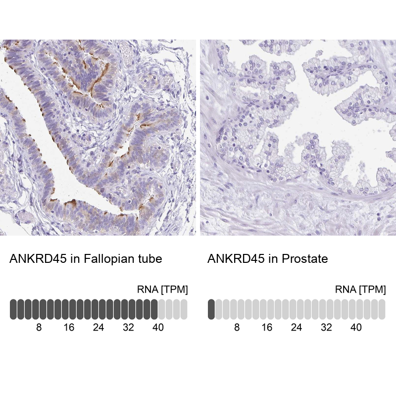 Anti-ANKRD45 Antibody