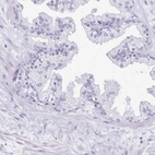Immunohistochemical staining of human prostate shows low expression as expected.
