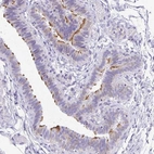 Immunohistochemical staining of human fallopian tube shows high expression.