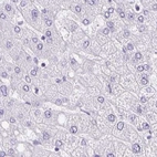 Immunohistochemical staining of human liver using Anti-ANKRD45 antibody HPA031657.