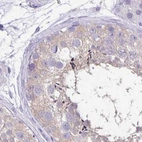 Immunohistochemical staining of human testis using Anti-ANKRD45 antibody HPA031657.