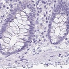 Immunohistochemical staining of human colon using Anti-ANKRD45 antibody HPA031657.