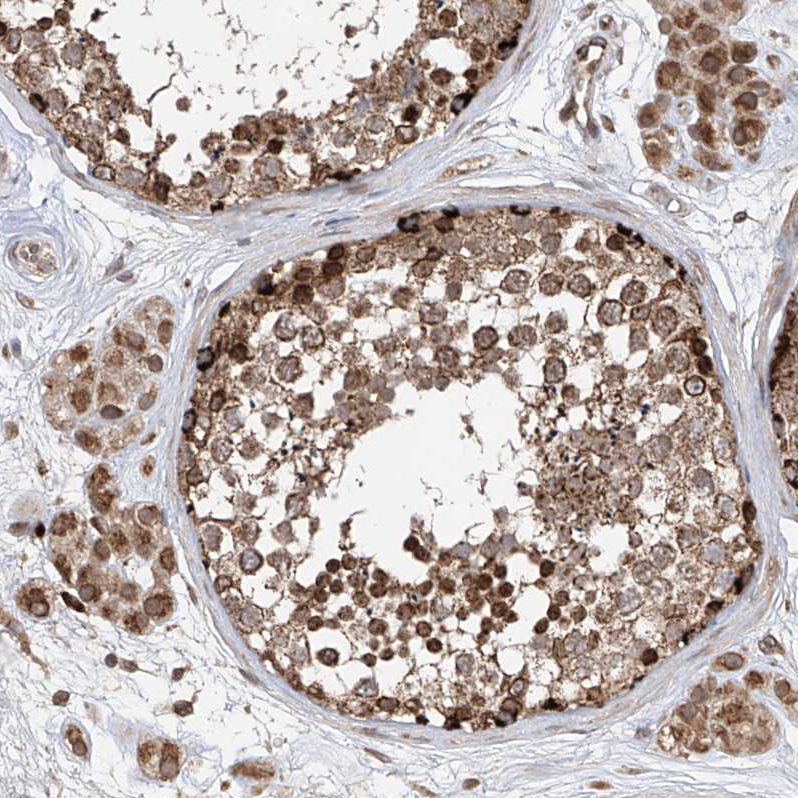 Anti-AHCTF1 Antibody