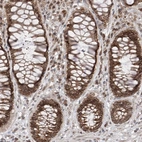 Immunohistochemical staining of human rectum shows strong positivity in nuclear membrane of glandular cells.