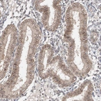 Immunohistochemical staining of human endometrium shows moderate positivity in nuclear membrane in glandular cells.