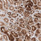 Anti-FUCA2 Antibody