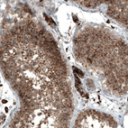 Anti-FUCA2 Antibody