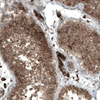 Immunohistochemical staining of human Testis shows strong cytoplasmic and extracellular space positivity in cells in seminiferous ducts and Leydig cells.