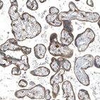 Immunohistochemical staining of human Placenta shows moderate cytoplasmic and extracellular space positivity in trophoblastic cells.