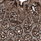 Immunohistochemical staining of human Colon shows strong cytoplasmic and extracellular space positivity in glandular cells.