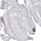 Immunohistochemical staining of human Skeletal muscle shows very weak cytoplasmic and extracellular space positivity in myocytes.