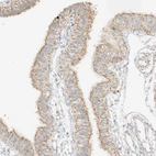 Immunohistochemical staining of human Fallopian tube shows moderate granular cytoplasmic positivity in glandular cells.