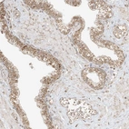 Immunohistochemical staining of human prostates shows moderate granular cytoplasmic positivity in glandular cells.