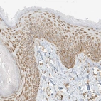 Immunohistochemical staining of human skin shows moderate granular cytoplasmic positivity in squamous epithelial cells.