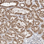 Anti-PPA2 Antibody