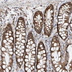 Immunohistochemical staining of human rectum shows strong granular cytoplasmic positivity in glandular cells.
