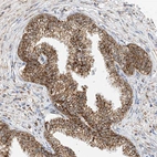 Immunohistochemical staining of human prostate shows strong granular cytoplasmic positivity in glandular cells.