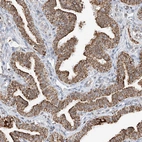 Immunohistochemical staining of human fallopian tube shows strong granular cytoplasmic positivity in glandular cells.