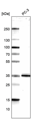 Western blot analysis in human cell line PC-3.