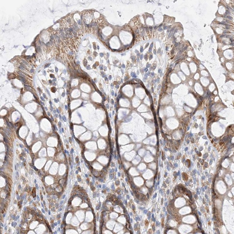 Anti-PPA2 Antibody
