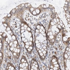 Anti-PPA2 Antibody