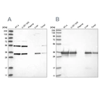 Western blot analysis using Anti-PPA2 antibody HPA031672 (A) shows similar pattern to independent antibody HPA031671 (B).