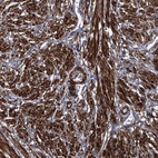 Immunohistochemical staining of human smooth muscle shows high expression.