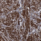 Immunohistochemical staining of human smooth muscle shows high expression.