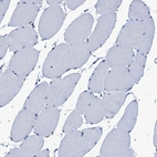 Immunohistochemical staining of human skeletal muscle shows low expression as expected.