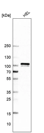 Western blot analysis in human cell line HEL.