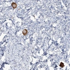Anti-TMEM209 Antibody