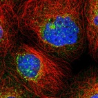 Immunofluorescent staining of human cell line A-431 shows localization to nuclear speckles, nuclear membrane & vesicles.