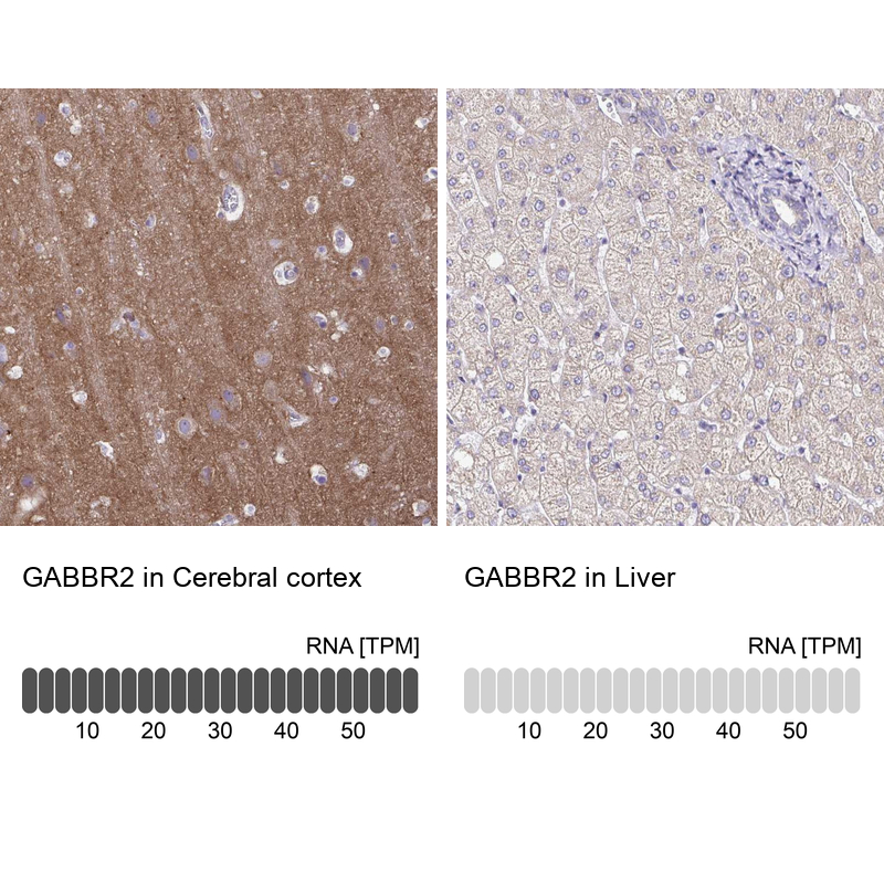 Anti-GABBR2 Antibody