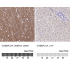 Anti-GABBR2 Antibody