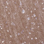 Immunohistochemical staining of human cerebral cortex shows high expression.