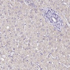 Immunohistochemical staining of human liver shows low expression as expected.