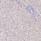 Immunohistochemical staining of human liver shows low expression as expected.