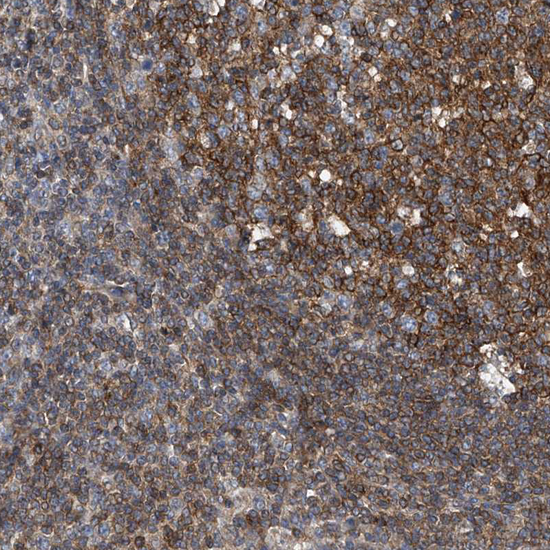 Anti-TRIM38 Antibody