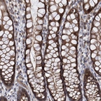 Immunohistochemical staining of human Rectum shows strong cytoplasmic positivity in glandular cells.