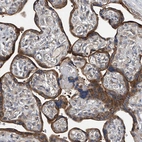 Immunohistochemical staining of human placenta shows moderate cytoplasmic positivity in trophoblastic cells.