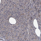 Immunohistochemical staining of human pancreas shows no cytoplasmic positivity in exocrine glandular cells.