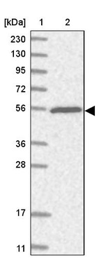 Anti-TRIM38 Antibody