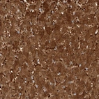 Immunohistochemical staining of human liver shows strong cytoplasmic positivity in hepatocytes.