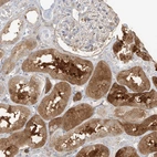Immunohistochemical staining of human kidney shows strong cytoplasmic positivity in cells in tubules.